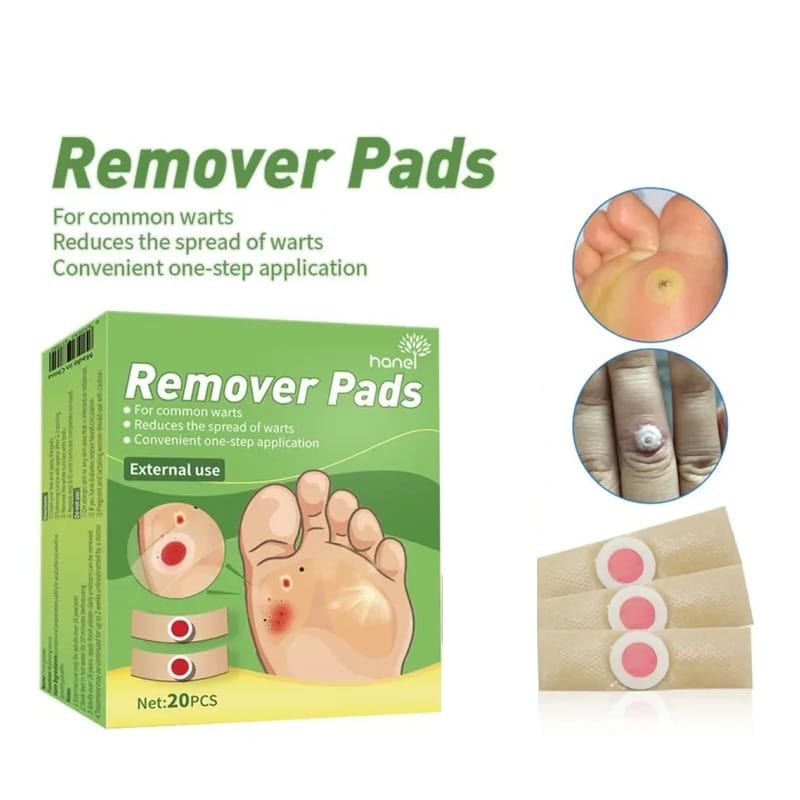 Wart Remover Pads RF2455- 20 pcs