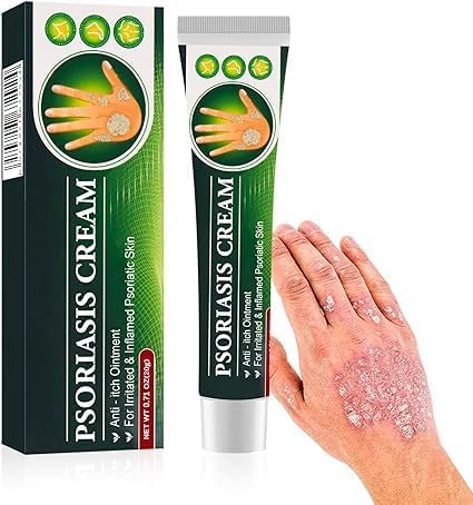 Psoriasis face and body cream, suitable for itching all over the body